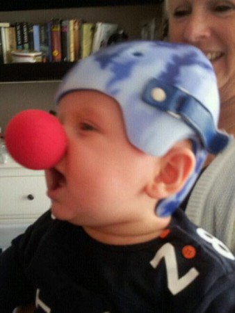 Onze kleine cliniclown